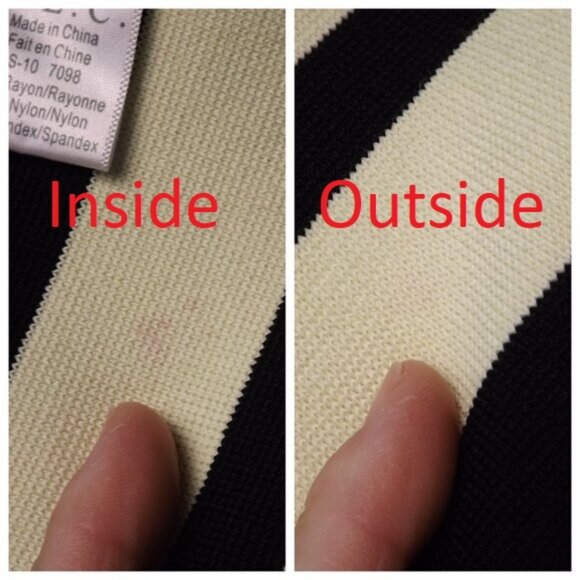 A.L.C. Dress, S, Pippa, Black/Yellow, F&F, Sleeveless, Striped, Small Flaws - Picture 8 of 12